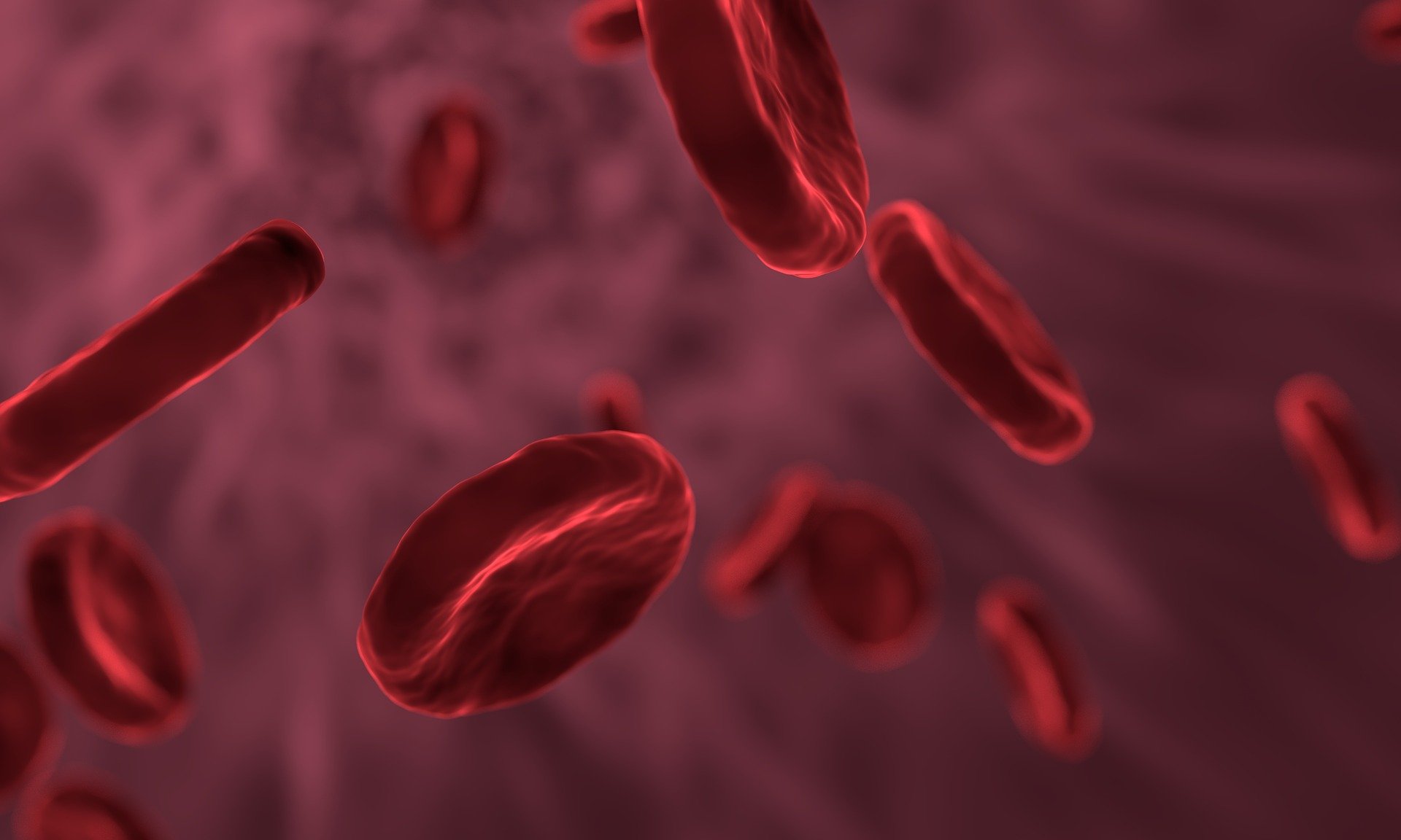 anemia