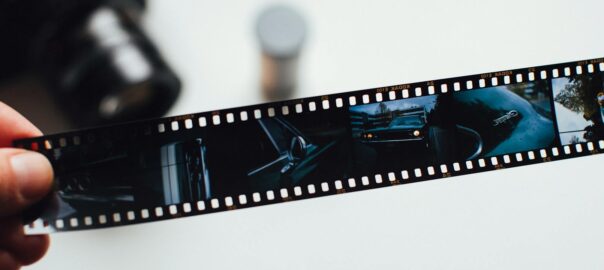 Memory Loss or Frequent Forgetfulness? Know When to Worry